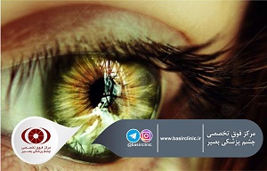 تازه‌های چشم‌پزشکی / بررسی نتایج حاصل از تکنیک LASIK-femto و تکنیک PRK به وسیلۀ میتومایسین