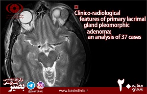 بررسي ويژگي هاي کلينيکي و راديولوژيك primary lacrimal gland pleomorphic adenoma